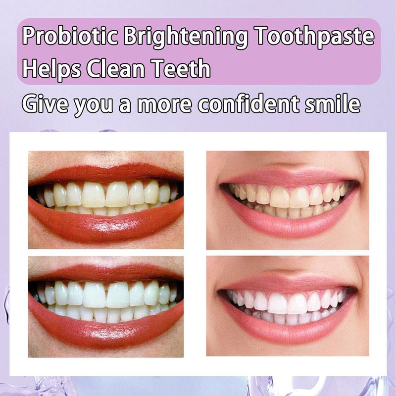 SP-6 Toothpaste Remove smoke stains, Oral Health Management,Fresh Breath,Probiotic Toothpaste for Oral Health Management, with Sodium Saccharin and Lactobacillus,Hydroxyapatite, Whitening Toothpaste