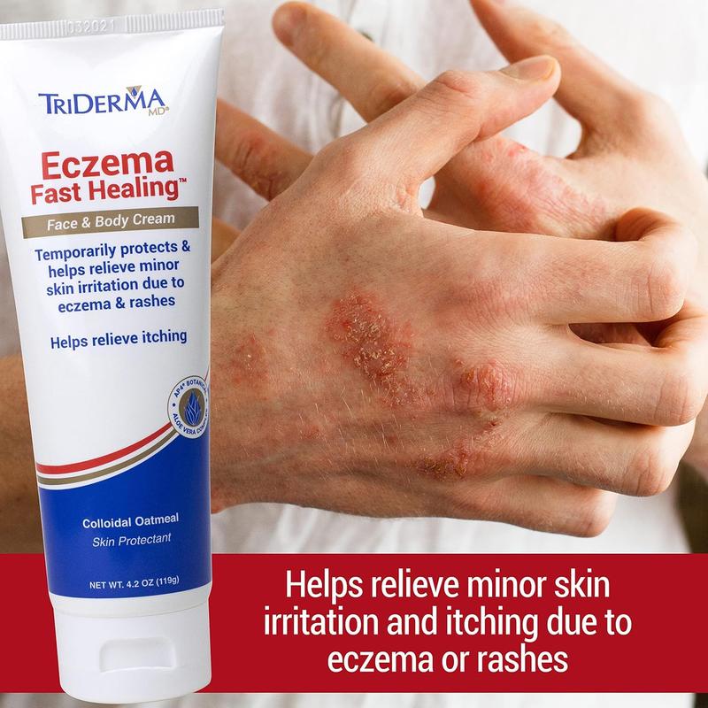 Triderma Eczema Fast Healing Cream, 4.2 Ounce by TriDerma