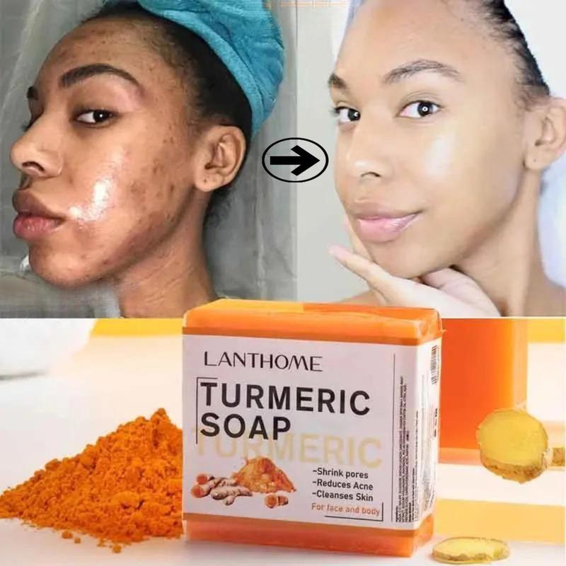 Turmeric Soap Bar For Face & Body,Turmeric Skin Soap Wash For Dark Spot, Intimate Areas, UnderarmsTurmeric Face Soap improving Acne Daily Skin Care