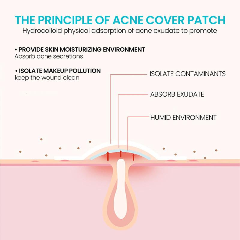 Pimple Cover Patch, Hydrocolloid Acne Cover Patches, Invisible Acne Patches, Facial Skin Care Products for Women & Men, Skincare Products