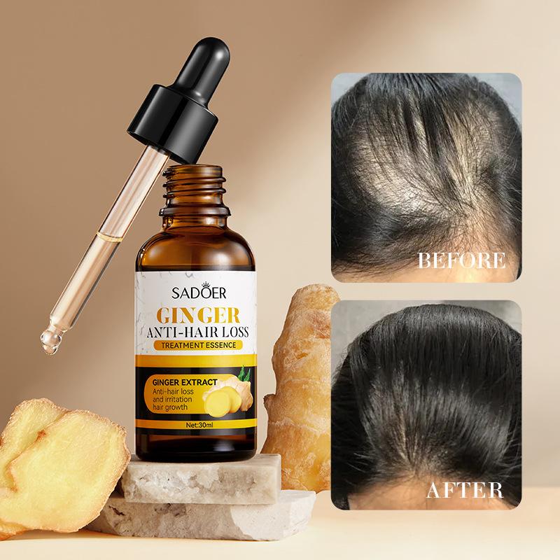 Ginger essence & Scalp Stimulator & Batana Oil -Blendedwith Jojoba & Argan Oil-100% OrganicEssential Oil forHair Haircare DailyRepairing Restore Moisture Vitamins & Hair Growth Essence