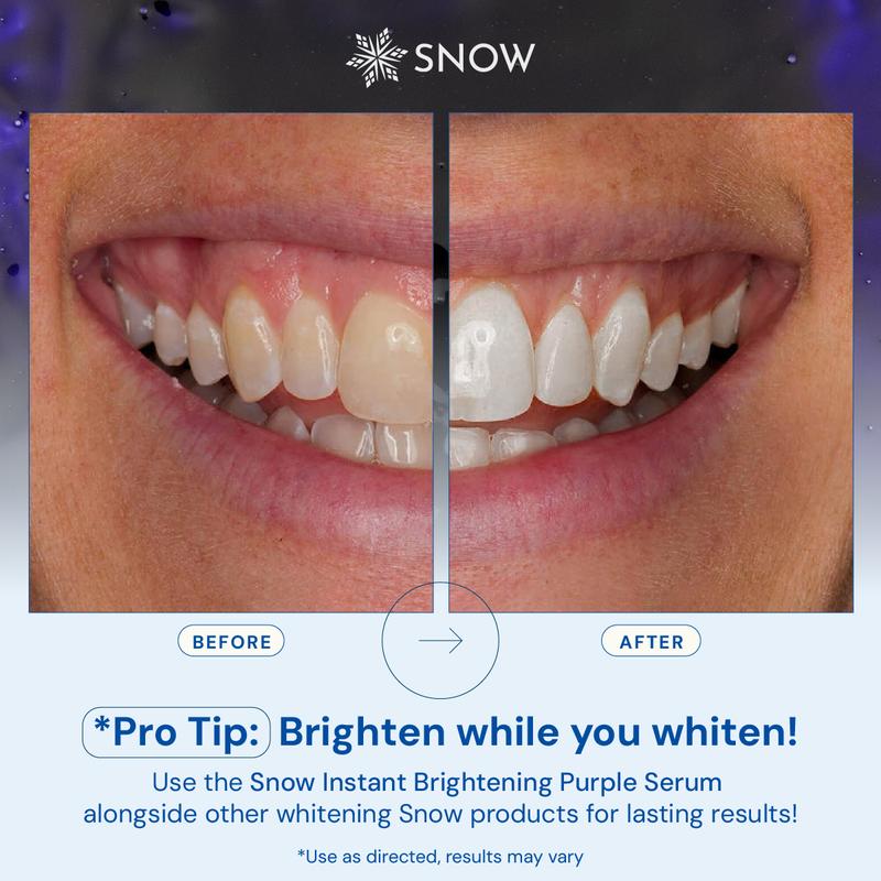 SNOW Teeth Brightening Purple Serum | Gentle & Enamel Safe Instant Brightening for Brighter Smile | Dental Care, Hygiene, & Tooth Care Oral Whitening