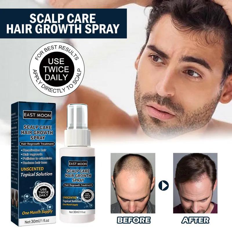 5% Minoxidil Spray - Nourishing Scalp Strengthens & Thickens Hair, Hair Growth Serum For All Types Hair