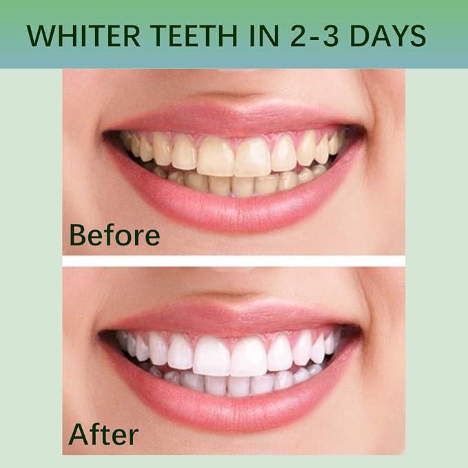 Teeth Whitening Strips,Crest whitening Strips,White Strips for Teeth whitening,Enamel Safe Non-Slip Dry Strip Technology for Whiter Teeth Oral Mild