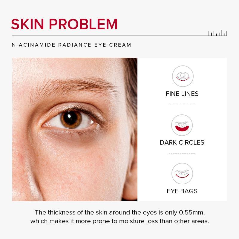 Firming Eye Creams, 3 Counts Niacinamide Radiant Eye Cream, Moisturizing Eye Creams, For Reducing The Look Of Age Spots, Christmas, Christmas Gift