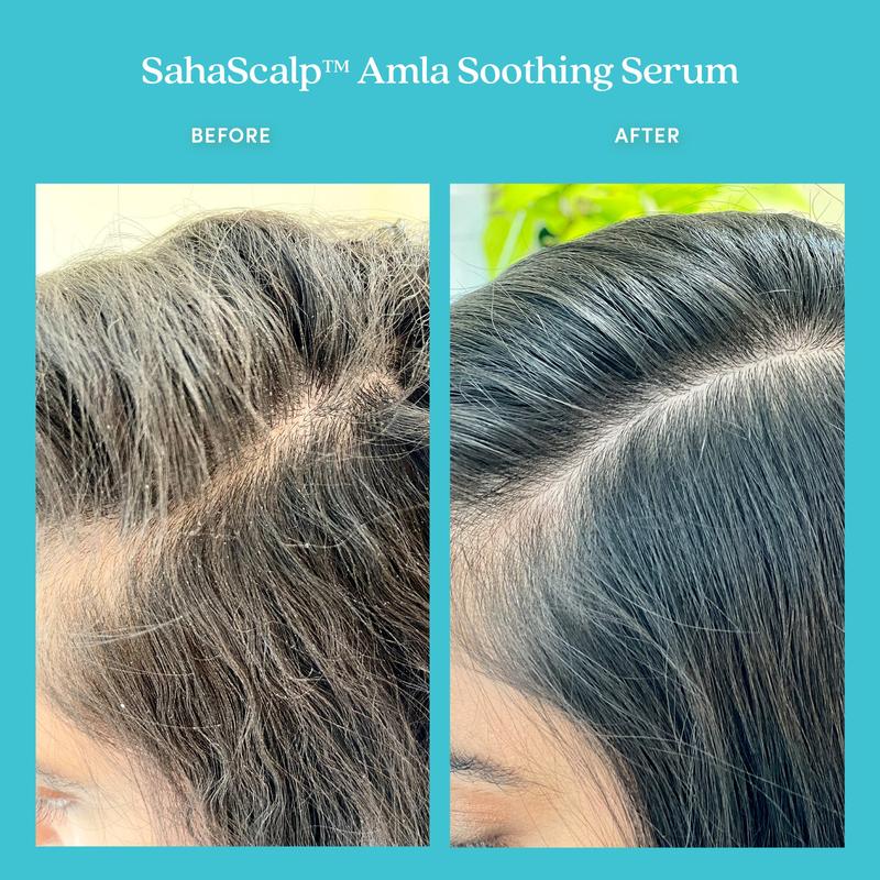 SahaScalp Amla Soothing Serum | For A Healthy, Balanced & Purified Scalp