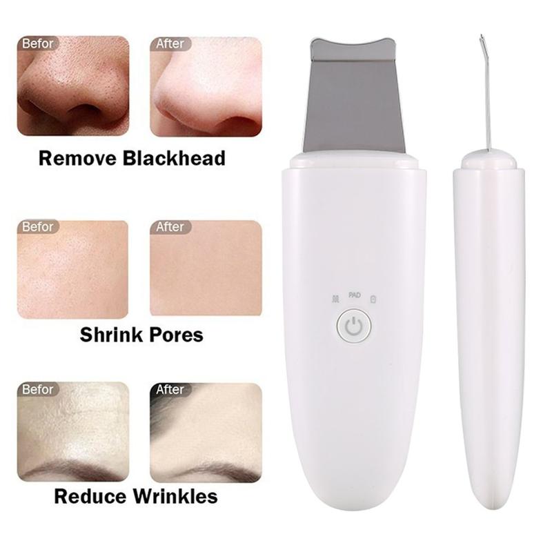 Ordinary Ultrasonic Skin Scrubber Blackhead Remover Pore Cleaner Facial Scrubber Comedones Extractor Facial Deep Cleansing Skin Care Comfort