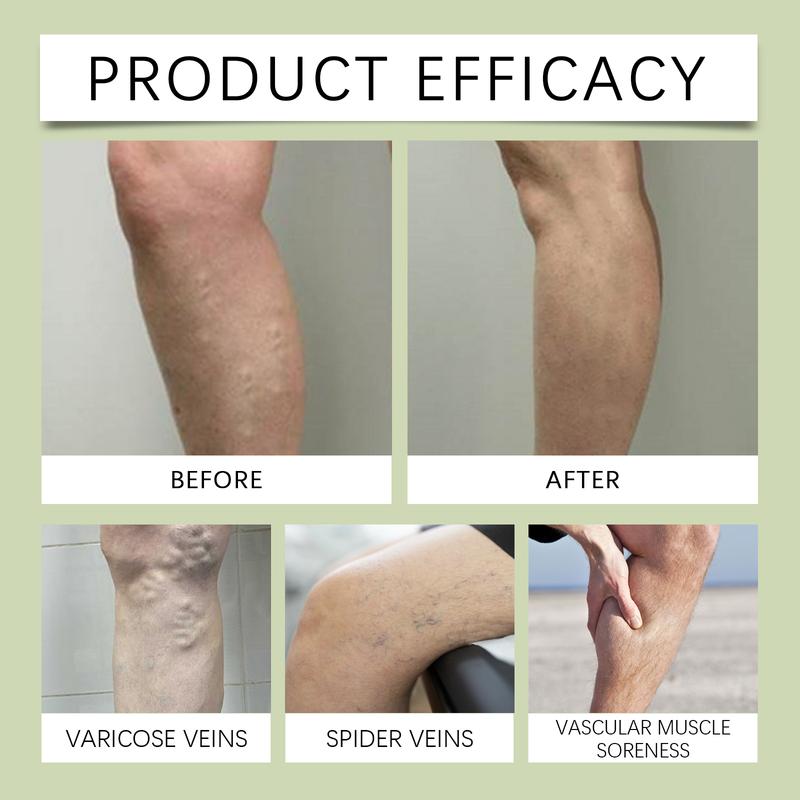 Leg vein care cream cares for and repairs leg skin and relieves leg discomfort skin oil