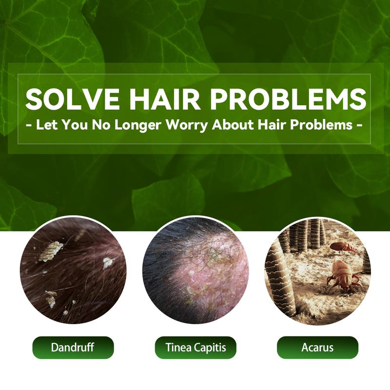 Scalp Ringworm Anti-itch Shampoo Anti-drop Refreshing Oil Control Hair Care Anti-dandruff Anti-itch Shampoo Deep into The Hair Root Protection Hair Follicle Anti-dandruff Anti-mite Anti-itch Prevent Dandruff Recurrence Conditioner Hair care